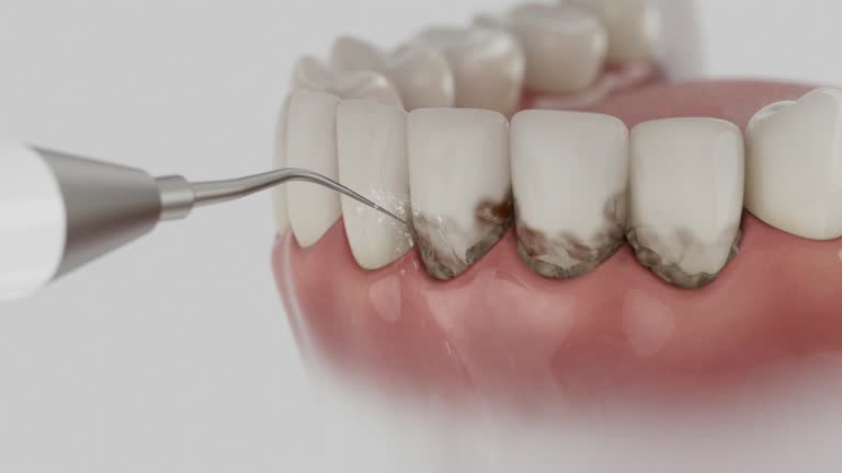 Reliable Dental Implants contractor in Lolo, MT by Smile Center Dentistry